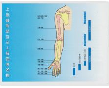 上肢截断部位及名称